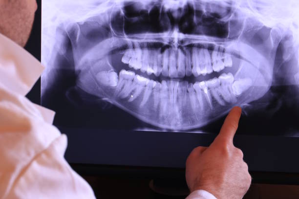 Best Holiday Emergency Dentist in Hidden Valley Lake, CA