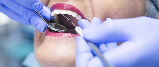 Best Weekend Emergency Dentist in Hidden Valley Lake, CA